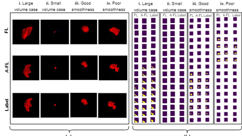 Enhancing Semantic Segmentation with Adaptive Focal Loss