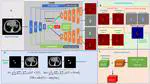 Uncertainty Driven Bottleneck Attention U-Net for Organ at Risk Segmentation